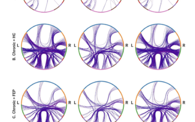 Mostly intact brain structure in early psychosis